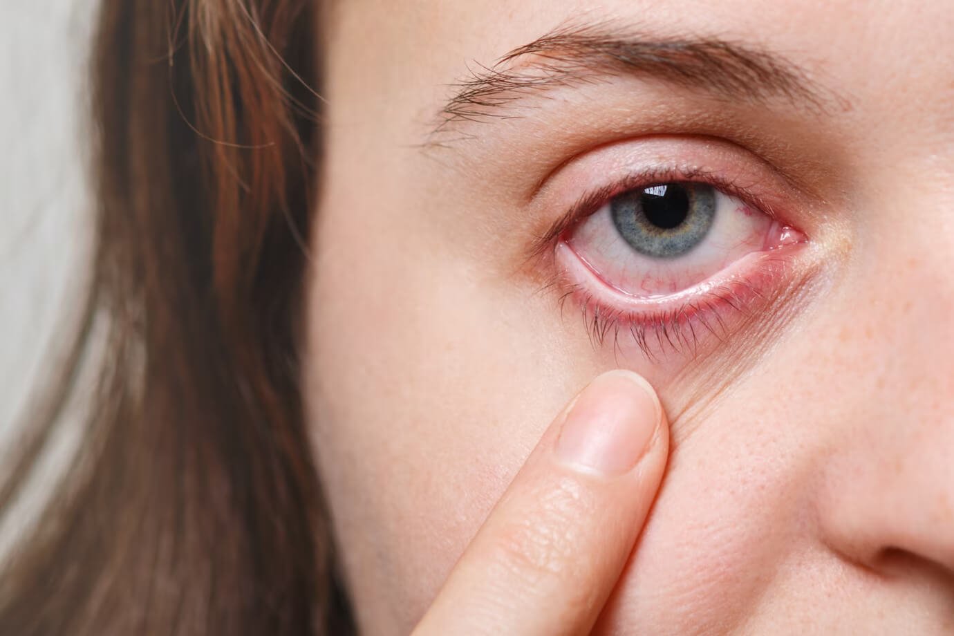 Ocular emergencies
